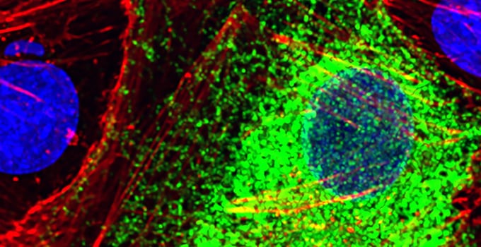 Una inteligencia artificial de Stanford aprende a leer la salud de una célula por los genes que enciende