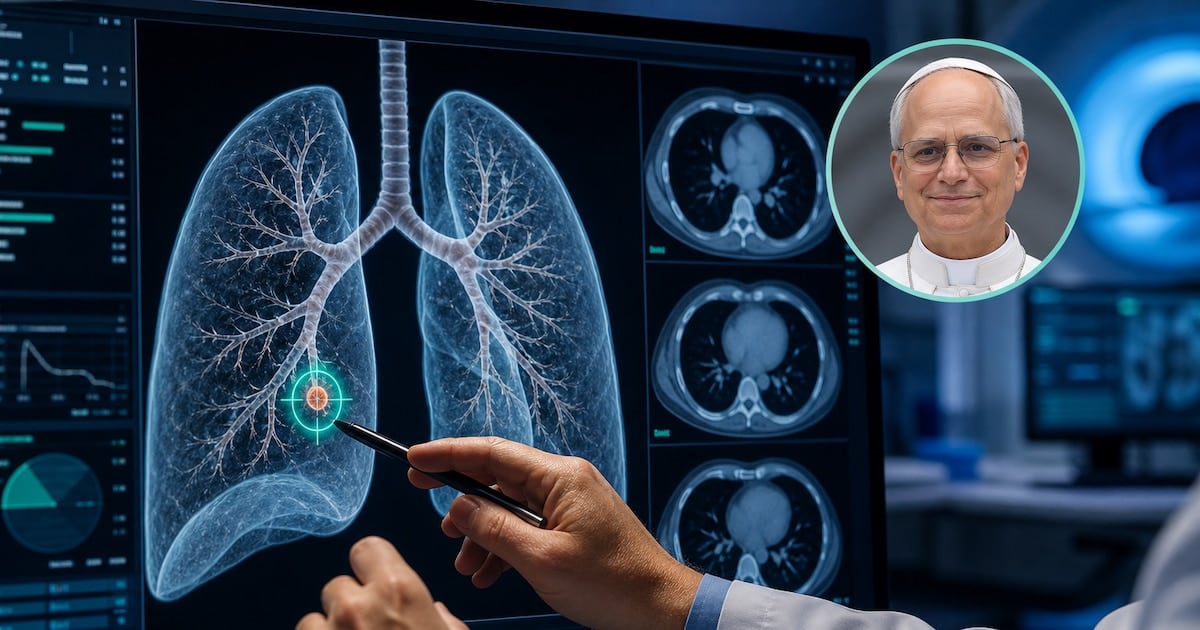 Tres milímetros que preocupan: cómo se decide hoy si un nódulo pulmonar va a quirófano